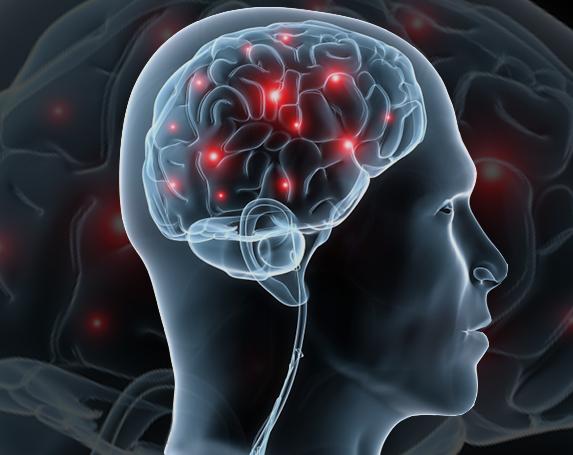 Drawing of xray of Brain with red lights for Peri spinal etanercept for brain injury