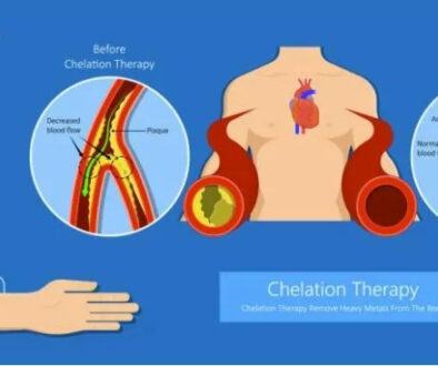 Chelation-for-Heart-and-Blood-vessel-disease-750x367 (1)