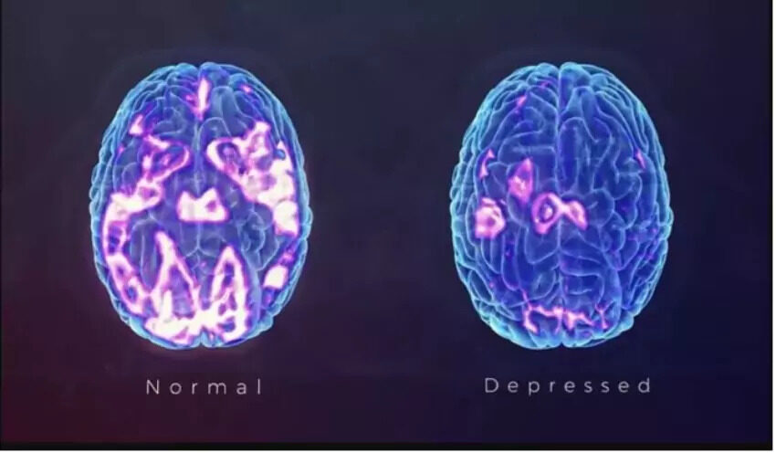 What Is Ketamine And Why Would You Want To Treat Mental Health Issues With It Toxnetlab