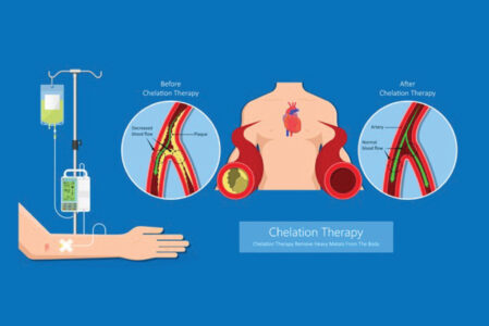 Heart Chelation Therapy info graphic