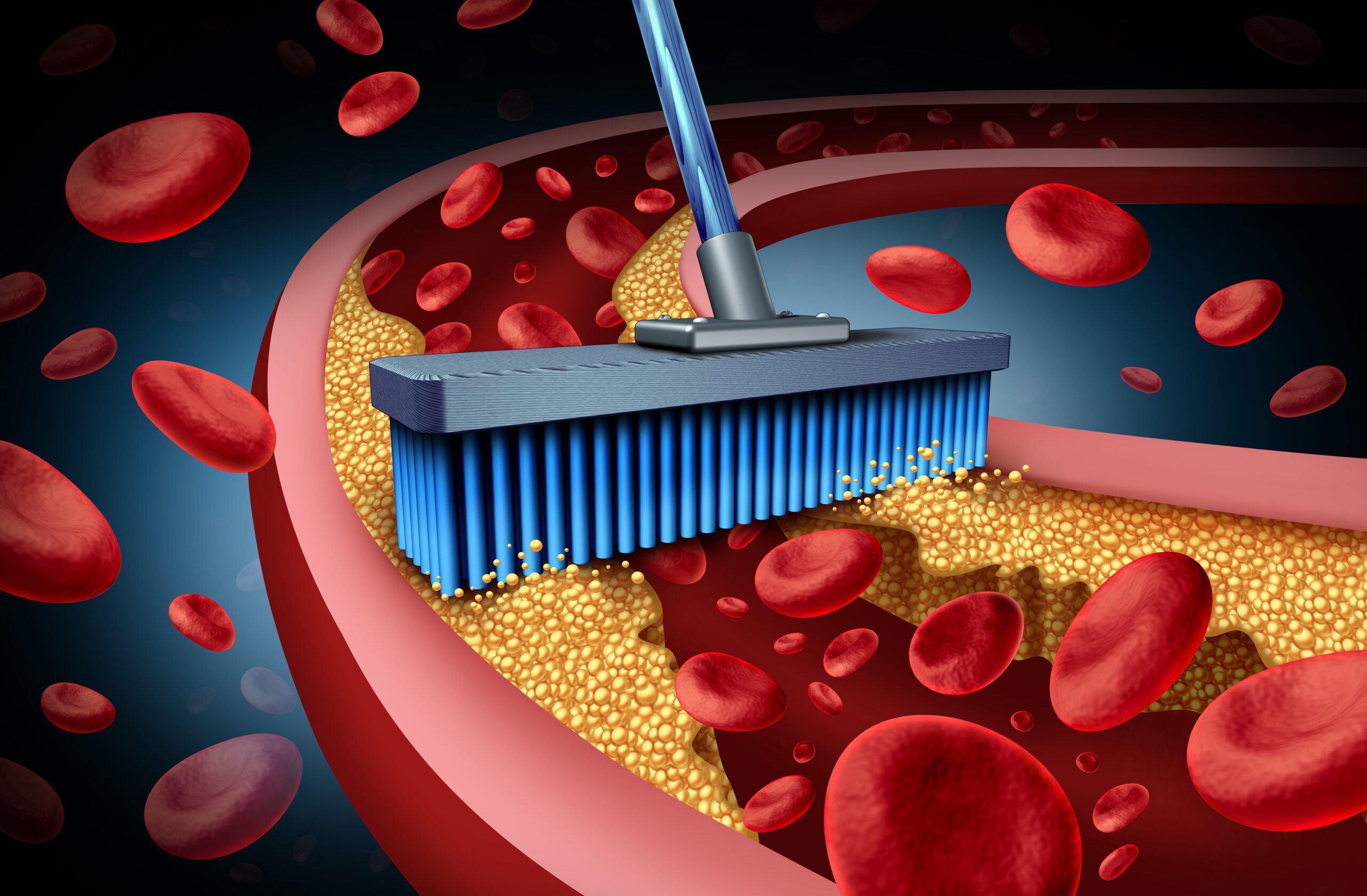 Chelation treatment and alternative therapy for heart disease concept for human blood circulation disease with 3D illustration elements.