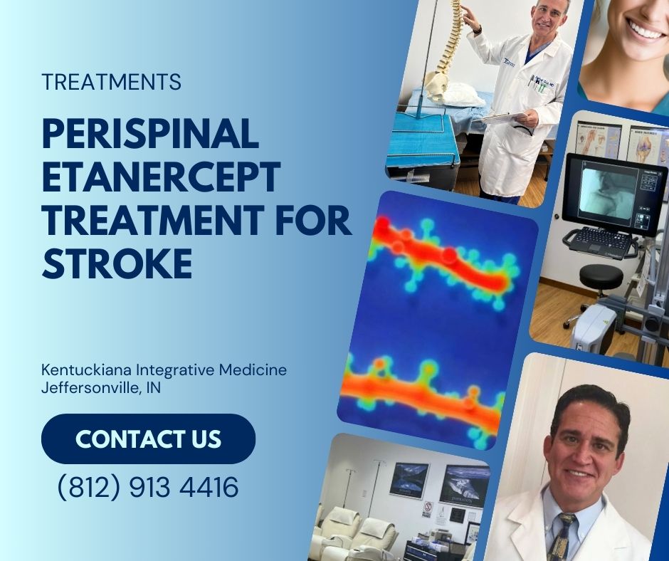 Perispinal Etanercept Treatment for Stroke